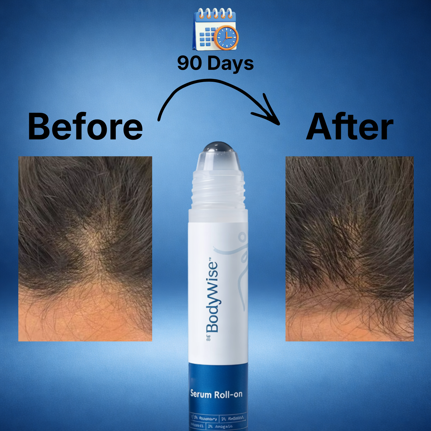 BeBodywise Hair Density Roll-On Serum